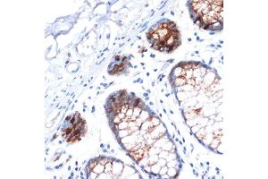 Immunohistochemistry of paraffin-embedded human colon using IGFBP2 Rabbit mAb (ABIN7267907) at dilution of 1:100 (40x lens). (IGFBP2 antibody)