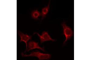ABIN6269096 staining HeLa by IF/ICC. (PKC beta antibody  (C-Term))