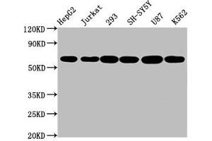 Western Blot Positive WB detected in: HepG2 whole cell lysate, Jurkat whole cell lysate, 293 whole cell lysate, SH-SY5Y whole cell lysate, U87 whole cell lysate, K562 whole cell lysate All lanes: CYP19A1 antibody at 2. (Recombinant Aromatase antibody)