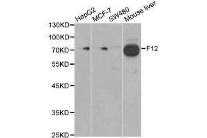 Western blot analysis of extracts of various cell lines, using F12 antibody. (F12 antibody)