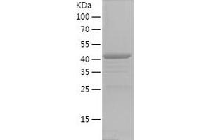 ERC1 Protein (AA 700-850) (GST tag)