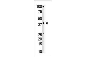 Image no. 1 for anti-BMI1 Polycomb Ring Finger Oncogene (BMI1) (C-Term) antibody (ABIN357748) (BMI1 antibody  (C-Term))