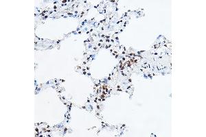 Immunohistochemistry of paraffin-embedded rat lung using YE Rabbit pAb (ABIN6130808, ABIN6150331, ABIN6150332 and ABIN6221925) at dilution of 1:100 (40x lens).