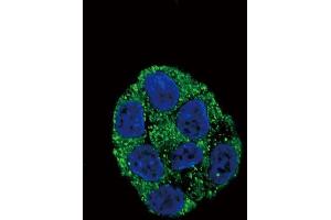 Confocal immunofluorescent analysis of PLA2G6 Antibody (Center) (ABIN653895 and ABIN2843138) with HepG2 cell followed by Alexa Fluor? (PLA2G6 antibody  (AA 551-580))