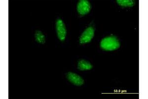 Immunofluorescence of purified MaxPab antibody to TAF1B on HeLa cell.