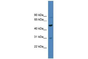 WB Suggested Anti-ZNF577 Antibody Titration:  0.