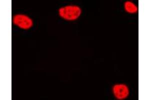 Immunofluorescent analysis of TCEB3C staining in Jurkat cells. (TCEB3C antibody  (C-Term))