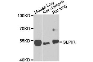 Western blot analysis of extracts of various cell lines, using GLP1R antibody (ABIN5996035) at 1/1000 dilution. (GLP1R antibody)