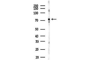anti-SAM Domain and HD Domain 1 (SAMHD1) (pThr592) antibody