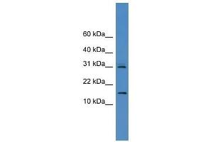 CST8 antibody used at 0. (CST8 antibody  (N-Term))