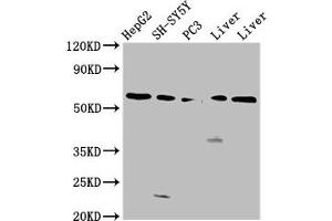 Western Blot Positive WB detected in: HepG2 whole cell lysate, SH-SY5Y whole cell lysate, PC-3 whole cell lysate, Rat liver tissue, Mouse liver tissue All lanes: UGT1A1 antibody at 4. (UGT1A1 antibody  (AA 395-482))