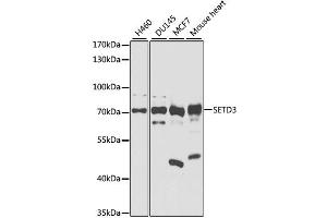 Western blot analysis of extracts of various cell lines, using SETD3 antibody. (SETD3 antibody)
