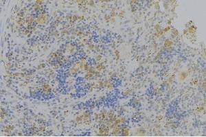 ABIN6276336 at 1/100 staining Human lymph node tissue by IHC-P. (Olfactomedin 1 antibody)