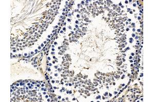 ABIN7096647 and ABIN7100712 at 1/100 staining rat testis tissue by IHC-P.