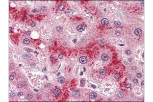 Human Liver (formalin-fixed, paraffin-embedded) stained with LEPRat 4 µg/ml followed by biotinylated anti-goat IgG secondary antibody, alkaline phosphatase-streptavidin and chromogen. (Leptin Receptor antibody  (Internal Region))