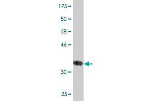 Western Blot detection against Immunogen (36. (HSD17B8 antibody  (AA 28-127))