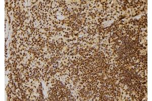 ABIN6264615 and ABIN6277712 at 1/100 staining Rat spleen tissue by IHC-P.
