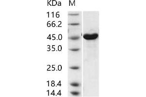 Western Blotting (WB) image for MERS-Coronavirus Nucleocapsid Protein (MERS-CoV N) protein (His tag) (ABIN7198809) (MERS-CoV Nucleocapsid Protein (His tag))