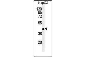 Western blot analysis of RDH13 Antibody  in HepG2 cell line lysates (35ug/lane). (RDH13 antibody  (Middle Region))
