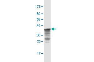 Western Blot detection against Immunogen (36. (PKC delta antibody  (AA 577-676))