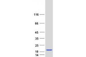 Hemoglobin, zeta (HBZ) protein (Myc-DYKDDDDK Tag)