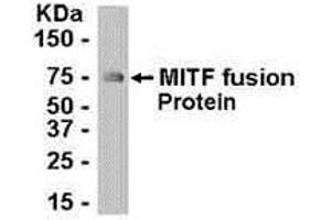 Western Blotting (WB) image for anti-Microphthalmia-Associated Transcription Factor (MITF) (AA 287-417) antibody (ABIN2467990) (MITF antibody  (AA 287-417))