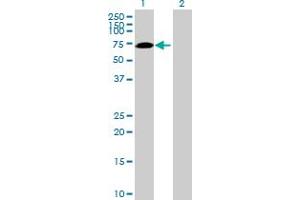 Western Blot analysis of SWAP70 expression in transfected 293T cell line by SWAP70 MaxPab polyclonal antibody. (SWAP70 antibody  (AA 1-585))