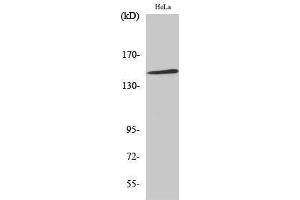 Western Blotting (WB) image for anti-Mitogen-Activated Protein Kinase 8 Interacting Protein 3 (MAPK8IP3) (Internal Region) antibody (ABIN3185265) (JIP3 antibody  (Internal Region))