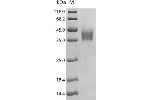 SLAM Family Member 7 (SLAMF7) (AA 23-226) (Active) protein (His tag)