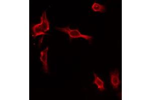 ABIN6274461 staining HepG2 by IF/ICC. (MAP4K1 antibody  (Internal Region))