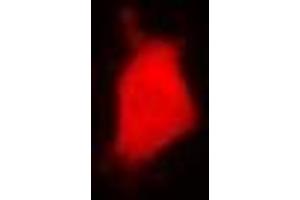 Immunofluorescent analysis of PARN staining in U2OS cells.