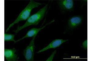 Immunofluorescence of monoclonal antibody to CTNNB1 on HeLa cell. (CTNNB1 antibody  (AA 682-781))