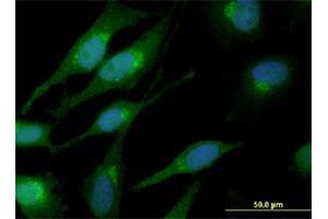 Immunofluorescence of monoclonal antibody to CTNNB1 on HeLa cell.