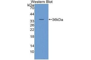 Western Blotting (WB) image for anti-Solute Carrier Family 2 (Facilitated Glucose Transporter), Member 14 (SLC2A14) (AA 51-105) antibody (ABIN1859031) (SLC2A14 antibody  (AA 51-105))