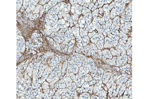 IHC analysis of FN1 using anti-FN1 antibody (ABIN7603470). (Fibronectin 1 antibody)