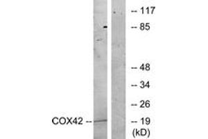 Western blot analysis of extracts from K562 cells, treated with insulin 0. (COX4I2 antibody  (AA 31-80))