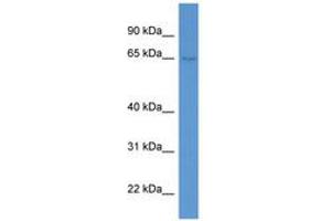 Image no. 1 for anti-Synaptotagmin Like Protein 1 (SYTL1) (AA 123-172) antibody (ABIN6746892) (SYTL1 antibody  (AA 123-172))