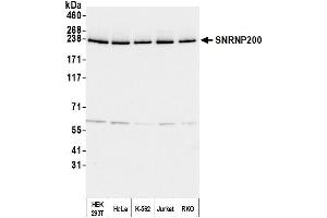 Western Blotting (WB) image for anti-Small Nuclear Ribonucleoprotein 200kDa (U5) (SNRNP200) (AA 400-450) antibody (ABIN7454918) (SNRNP200 antibody  (AA 400-450))