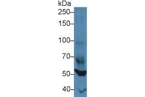 Western blot analysis of Mouse Heart lysate, using Mouse FOXP1 Antibody (3 µg/ml) and HRP-conjugated Goat Anti-Rabbit antibody ( (FOXP1 antibody  (AA 122-346))