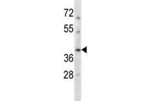RAD51C antibody western blot analysis in HepG2 lysate. (RAD51C antibody  (AA 169-198))