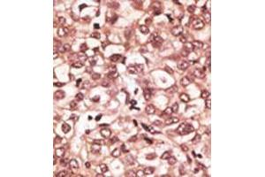 Image no. 2 for anti-Toll-Like Receptor 6 (TLR6) (C-Term) antibody (ABIN357053) (TLR6 antibody  (C-Term))