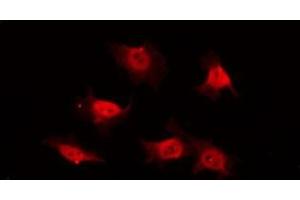ABIN6269202 staining COS7 by IF/ICC. (PI3K p85 alpha/gamma antibody)