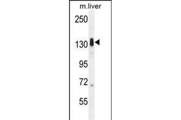 LMTK3 Antikörper  (N-Term)