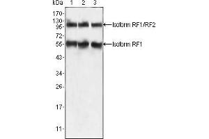 Western blot analysis using PEG10 mouse mAb against HepG2 (1), SMMC-7721 (2) and A549 (3) cell lysate. (PEG10 antibody)