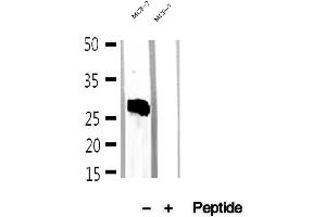 Western blot analysis of extracts of MCF-7 cells, using Mast Cell Chymase antibody.
