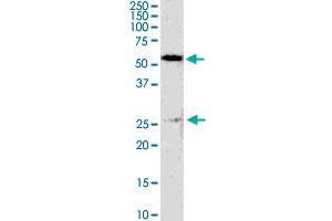 GSTM4 monoclonal antibody (M01), clone 4B4. (GSTM4 antibody  (AA 23-119))