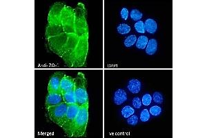 (ABIN570961) Immunofluorescence analysis of paraformaldehyde fixed A431 cells, permeabilized with 0.