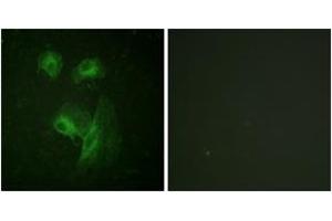 Immunofluorescence (IF) image for anti-Ribosomal Protein S6 Kinase, 70kDa, Polypeptide 1 (RPS6KB1) (AA 195-244) antibody (ABIN2888683) (RPS6KB1 antibody  (AA 195-244))