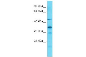 Host: Rabbit Target Name: IST1 Sample Type: COLO205 Whole Cell lysates Antibody Dilution: 1. (IST1 antibody  (C-Term))