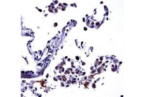 IL-13 antibody immunohistochemistry analysis in formalin fixed and paraffin embedded human lung tissue. (IL-13 antibody  (AA 118-146))